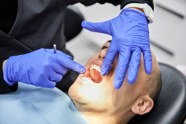 Best Weekend Emergency Dentist in Camano, WA